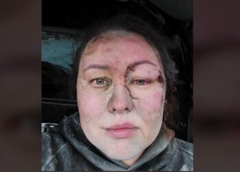 FOTO/ “Jam gjallë”! E bllokuar prej orësh, trajnerja e ekipit kombëtar në Ukrainë nxirret nga rrënojat pas sulmit nga raketat ruse