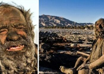 FOTO: 70 vite pa u larë, njeriu më i pisët në botë habiti mjekët që e ekzaminuan