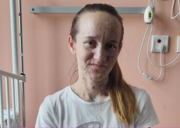 I verboi bomba ruse që i shpërtheu në banesë/ Historia tragjike e nënës ukrainase me dy binjakët e saj