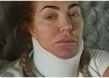 FOTOT/ Banorja e ‘’Big Brother’’ bën aksidentin fatal, ja gjendja e saj