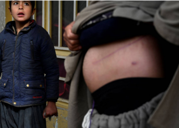 Tmerr në Afganistan/ Prindërit po shesin veshkat e fëmijëve për të fituar para se janë të mbytur në borxhe