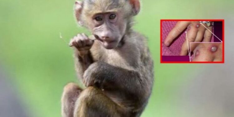 Disa shtete kanë nisur vaksinimin/ OBSH thirrje për masa: Lia e majmunëve nuk do...