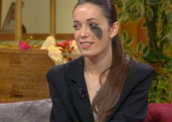 ‘Kush ta ka nxirë syrin’? Flet vajza me nishan në fytyrë: Jam gjykuar dhe nga të rriturit