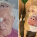 “Mendova se do të vdisja”, 75-vjeçarja sulmohet nga qeni Pitbull: E ndjeja duke më kafshuar kokën