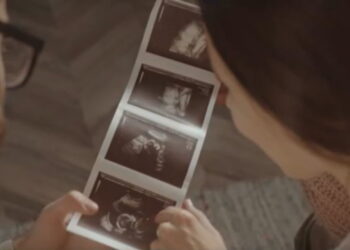 “Rekordi i zi” i Shqipërisë në rajon: 26 mijë aborte në pesë vitet e fundit