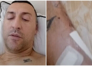 “Më përplasi me qëllim, tani është i lirë”/ Pas aksidentit këngëtari shqiptar habit me deklaratën: Policia s’më ndihmon sepse jam shqiptar