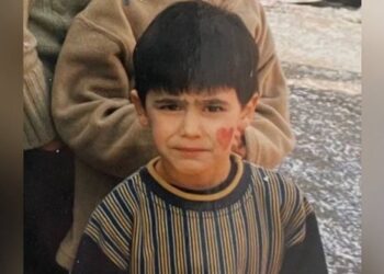 A ka ndryshuar? Sot është një ndër emrat më të njohur të muzikës shqiptare, kështu dukej para famës (FOTO)