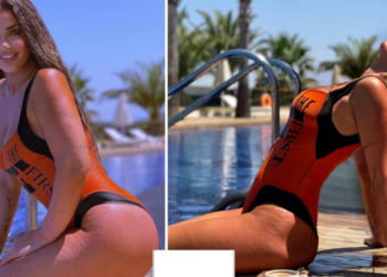 Revoltohet aktorja shqiptare pasi e akuzuan për “photoshop”: Kam celulit është normale, jam nënë e 3 fëmijëve