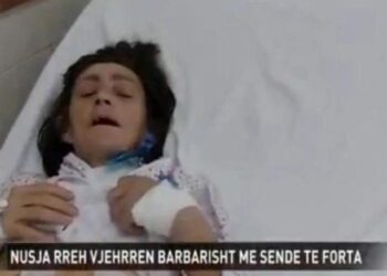 Reagon nusja që bëri vjehrrën për spital: Më thoshte s’ke punë të ndërhysh tek gjërat e mia