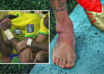 Neymar e nis Botërorin e Katarit me dëmtim, ja si ia kanë masakruar serbët kyçin e këmbës