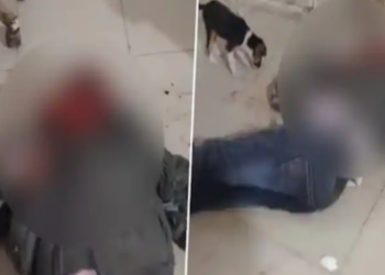Bëhet viral momenti kur qeni lëpin gjakun e pacientit në spital, pushohen nga puna 6 punëtorë shëndetësorë
