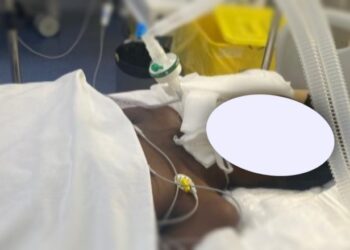 22-vjeçarja nga Kenia masakrohet në rrugë, u gjet pa ndjenja pranë banesës në Tiranë