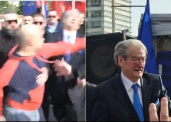 FOTO/ U godit në fytyrë me grusht, ja si është gjendja e Sali Berishës