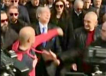 Goditi me grusht në fytyrë Berishën, doktori i Gert Shehut: Raportin mjekësor e kam lëshuar unë, ka sjellje agresive