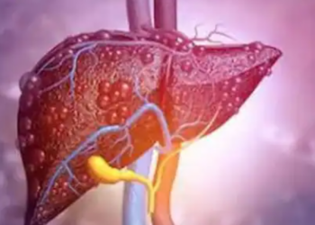 Trajtimi i kancerit të mëlçisë bëhet më efektiv, opsionet e reja tregojnë premtimin