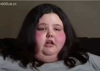FOTO/ Duket tjetër njeri: Dikur peshonte 317 kilogramë, tani gruaja nuk njihet me pamjen e re