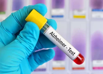 Zbulohet testi i gjakut që do të zbulojë Alzheimerin që në momentet e para