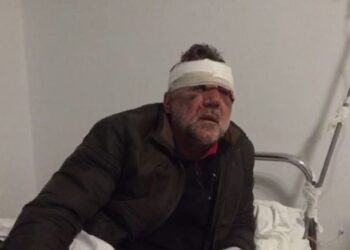 “Hip në makinë se do të japim kafe”, profesori në Tepelenë tregon si e dhunuan të rinjtë me ‘Audi’