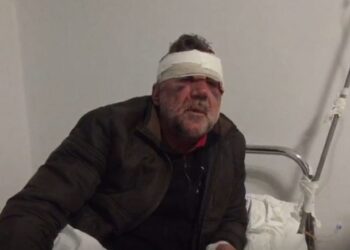 “Më ngacmon mësuesi”, vëllai bën për spital profesorin në Tepelenë pas pretendimit të motrës së mitur