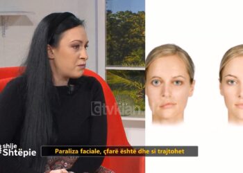 Pacientja me paralizë faciale: Mendova se ishte dhimbje veshi, por u zgjova me fytyrë të deformuar