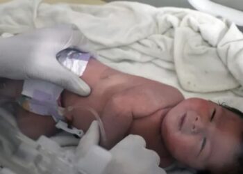 Aya, mrekullia që lindi nën rrënojat e tërmetit, tentohet të rrëmbehet në spital. Autorët rrahën drejtorin