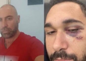Emri/ “Do ta bëj trupin thela-thela”! Autori i aksidentit në Vlorë, ish-drejtori i doganës Fier që kërcënoi burrin e dashnores