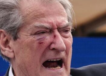 Lajmësi i orgjive të grave deputete ankohet për vibratorët e Ahmetajt