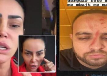 Fisnik Syla ‘i nxjerr të palarat’ ish-bashkëshortes: Fjolla Morina shkon tek psikiatri