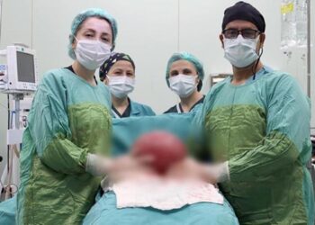 Shkoi në spital me fryrje e dhimbje barku, mjekët i heqin tumorin 3 kilogramë e 750 gramë