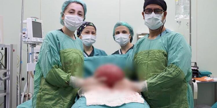 Shkoi në spital me fryrje e dhimbje barku, mjekët i heqin tumorin 3 kilogramë e 750 gramë