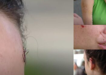 FOTOT/ Si u dhunua e reja nga i dashuri, erdhi nga Gjermania për të, por e priti…tmerri!