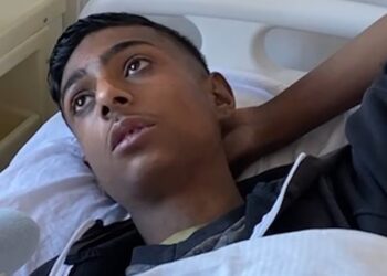 Ish-njerku i dogji banesën në Llakatund, 14-vjeçari: Na rrahu, bashkë me gjyshen jemi djegur nga këmbët
