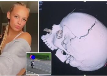 VIDEO/ Vajza rrëmbehet nga ish-i dashuri dhe rrëzohet nga furgoni në lëvizje, i çahet kafka por mbijeton