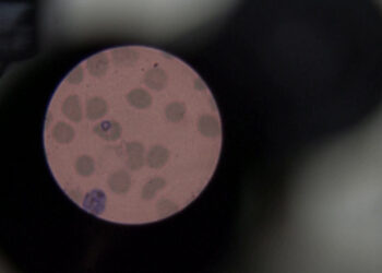 Ja pse pandemia e radhës mund të vijë nga Brazili