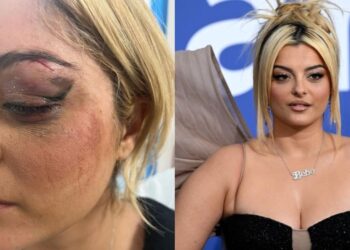 “Po përpiqesha të shihja nëse…”, agresori tregon pse e goditi me telefon Bebe Rexhën