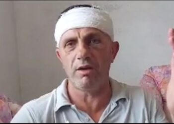 Sherri për guroren/ Flet i plagosuri në Borizanë: Më goditën me tyta armësh. Kemi dhe video të tjera