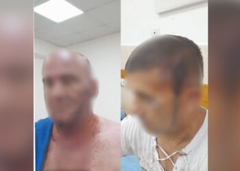 Dalin fotot/ Të gjakosur e me plagë të rënda, gjendja e dy kushërinjve pas dhunimit me shkopinj nga fisi Rraja