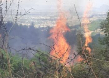 I vuri zjarrin shkurreve teksa pastronte, flakët përhapen dhe lëndojnë 67-vjeçarin në Durrës
