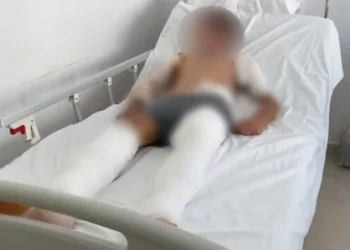 Ngjarja e rëndë në Delvinë/ 12-vjeçari sulmohet nga 6 qentë e një kopeje, merr plagë të rënda