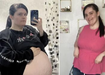 Njerëzit mendonin se ishte shtatzënë, 26-vjeçarja heq kistin 16-kilogramësh në barkun e saj