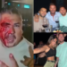 Grushte e gjak/ Çfarë ndodhi në restorantin ku Messi dhe Beckham darkonin me bashkëshortet