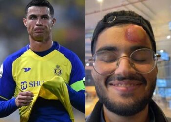VIDEO| Topi godet kameramanin në vend të rrjetës, gjuajtja e Cristiano Ronaldos nuk shkon si duhet