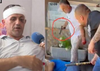 U dhunua nga fisi Rraja, Jashar Maja: Jam shumë i zhgënjyer nga shteti, nuk di ku të ankohem