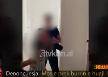 “E ka mbytur burri atë, ka pasur dëmtime cerebrale”, agresori endet i lirë pas dhunës ndaj ish-gruas