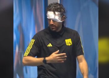 17 të plagosur dhe 12 qepje për trajnerin Grosso, Lyoni përjeton mbrëmje makthi ne Marseille