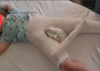 “Edukatorja më rrahu”, dëshmi rrëqethëse të babait të 3-vjeçares: Vajza filloi duke folur rrjedhshëm tek “Trauma”