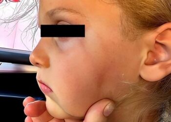 Skandali/ Ndodh dhe në kopshtin e Durrësit, dhunohet e mitura, denoncimi nga familja: Nuk është hera e parë