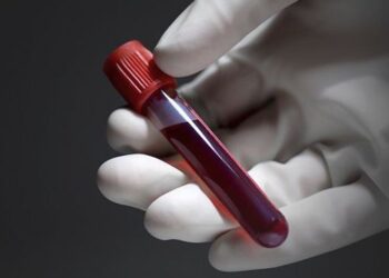 Një analizë e re gjaku mund të zbulojë se cili organ do të plaket më shpejt