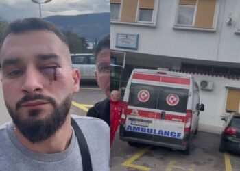 Të rinjtë e dhunuar kthehen në atdhe, policia: U shoqëruan nga homologët e Malit të Zi. Nga kontrollet mjekësore doli se…