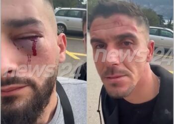 VIDEO/ Me plagë në sy dhe hematoma, ja kush janë të rinjtë e dhunuar në Mal të Zi nga një grup serbësh